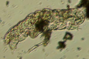 Tardigrade