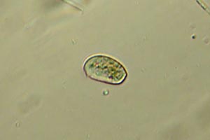 Ciliate