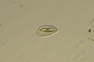 Ciliate