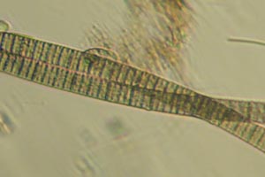 Cyanobacteria