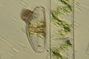 Diatom