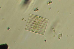 Diatoms