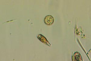 Diatoms