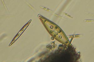Diatoms
