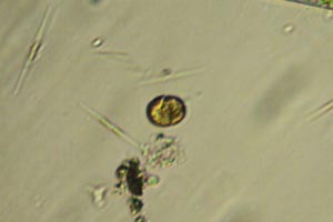 Dinoflagellate