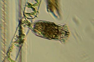 Cephalodella cf auriculata