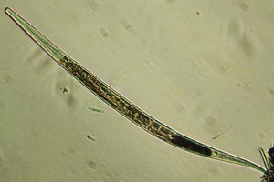 Roundworm