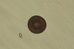 Arcellid shell