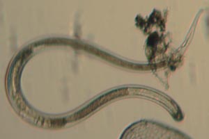 Roundworm