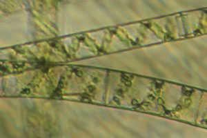 Spirogyra