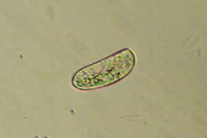 Ciliate