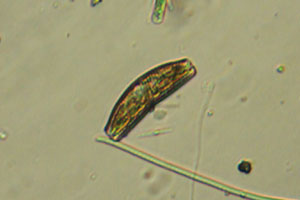 Diatom