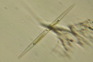 Diatom