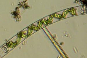 Spirogyra