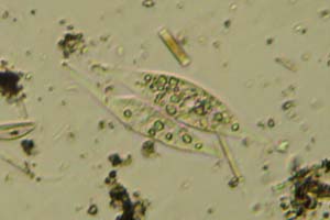 Litostomes, conjugating