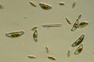 Diatoms