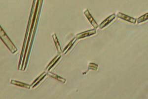 Diatoms