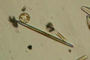 Diatoms