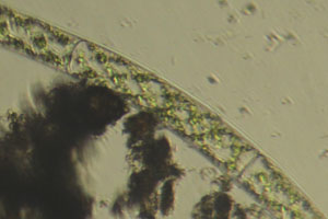 Spirogyra