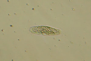 Spirotrich