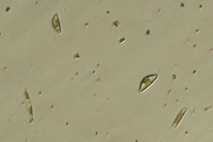 Diatoms