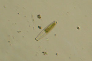 Diatom