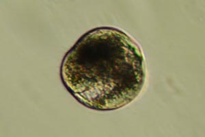 Ciliate