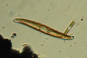Diatom