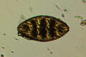 Cymatopleura