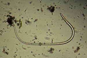 Roundworm