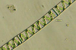 Spirogyra