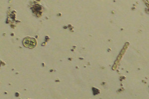 Cyanobacteria, Cosmarium
