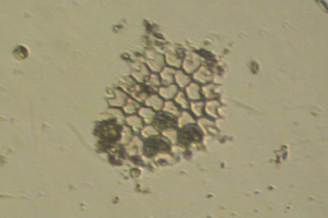Pseudopediastrum