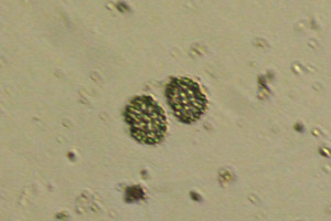 Cyanobacteria