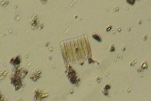 Diatoms