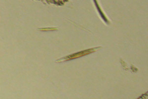 Diatoms