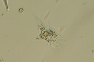 Amoebozoa