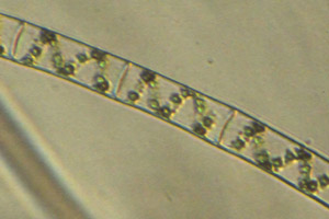 Spirogyra