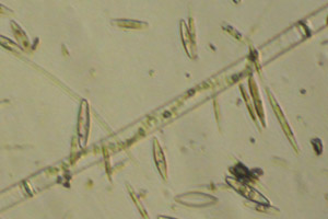 Spirogyra