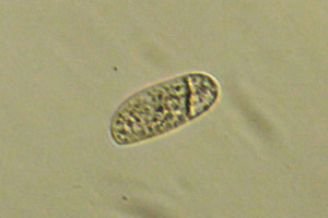 Ciliate