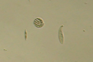 Ciliates