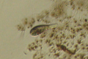 Ciliate