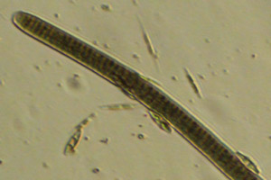 Cyanobacteria
