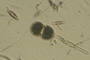 Cyanobacteria