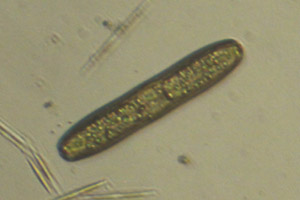 Diatom