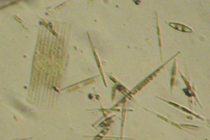 Diatoms