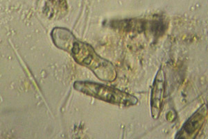 Diatoms
