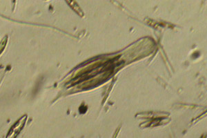 Chaetonotid