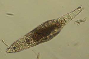 Bdelloidea