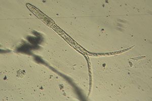 Fluke larva